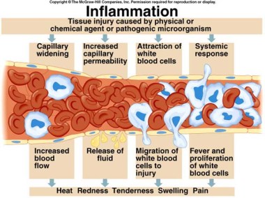 inflammation